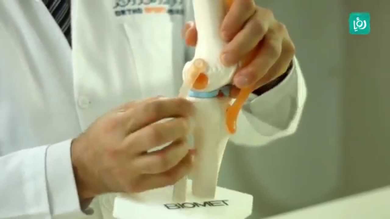 الأصابات الرياضية للركبة - الأطباء السبعة - ج 4