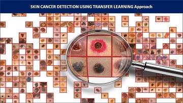 Part 1 | Skin Cancer Detection Using Transfer Learning Deep CNN Approach | Computer Vision Project