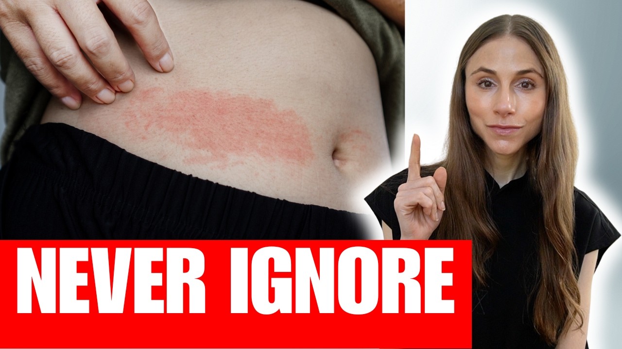 Avoids Rash Dermatologist Explains Rashes That Should NEVER Be Ignored - YouTube