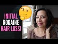 DOES ROGAINE CAUSE YOUR HAIR TO FALL OUT FIRST? (My experience with hair falling out when I started)