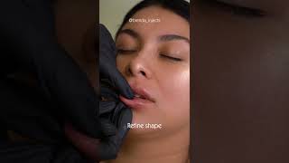 Lip Filler Content Session for Aesthetic Clinics | Houston