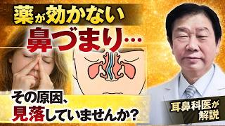 薬が効かない鼻づまり…その原因は1つではありません【耳鼻科医解説】