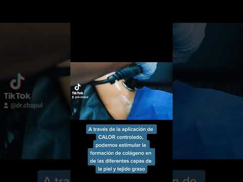 Radiofrecuencia - Flacidez