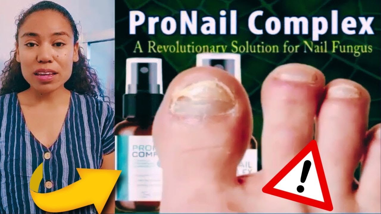 PRONAIL COMPLEX REVIEWS (❌ NEW ALERT ❌) – PRONAIL COMPLEX TOENAIL FUNGUS