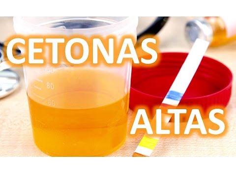 Vídeo: Acetona En Niños: Causas, Síntomas, Tratamiento