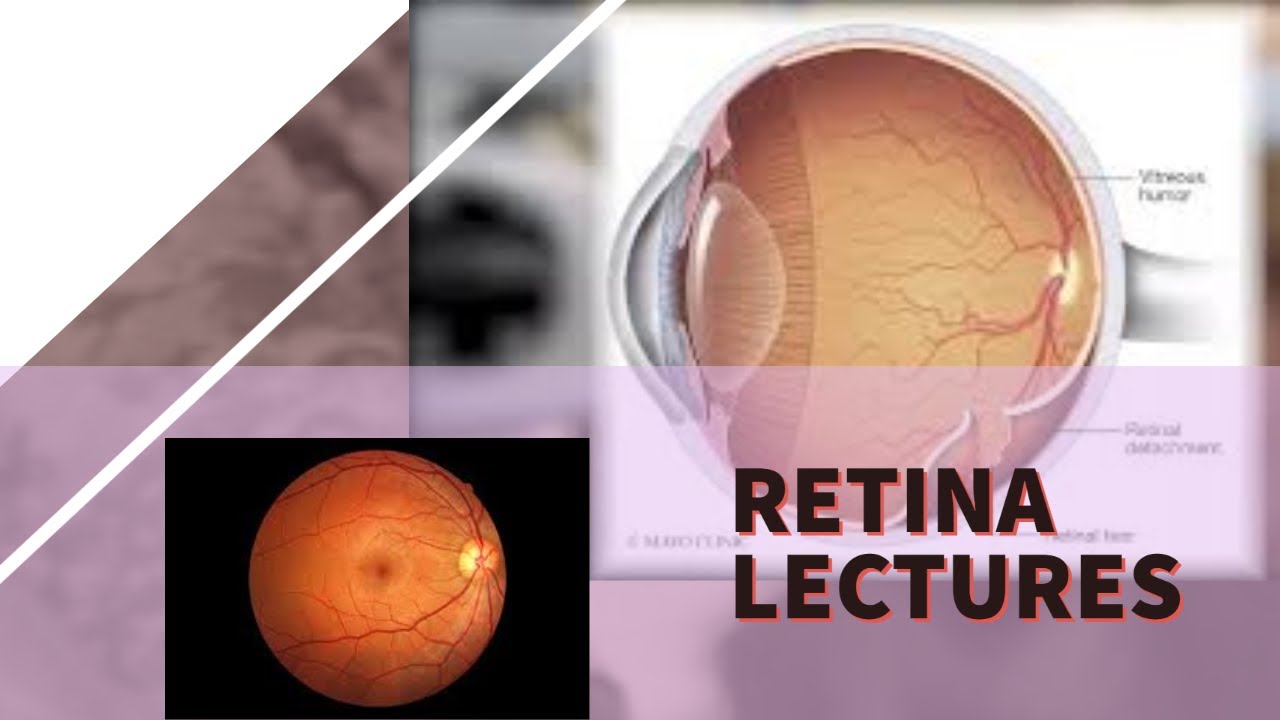 RETINA lecture 9 HYPERTENSIVE RETINOPATHY easiest explanation with