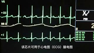 ADS1299IPAG -16-Channel Analog Front-End (AFE) Chip for Biomedical Signal Acquisition and Processing