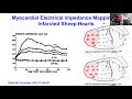 Biophysics of Pulsed Electrical Field Ablation