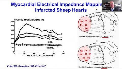 Biophysics of Pulsed Electrical Field Ablation