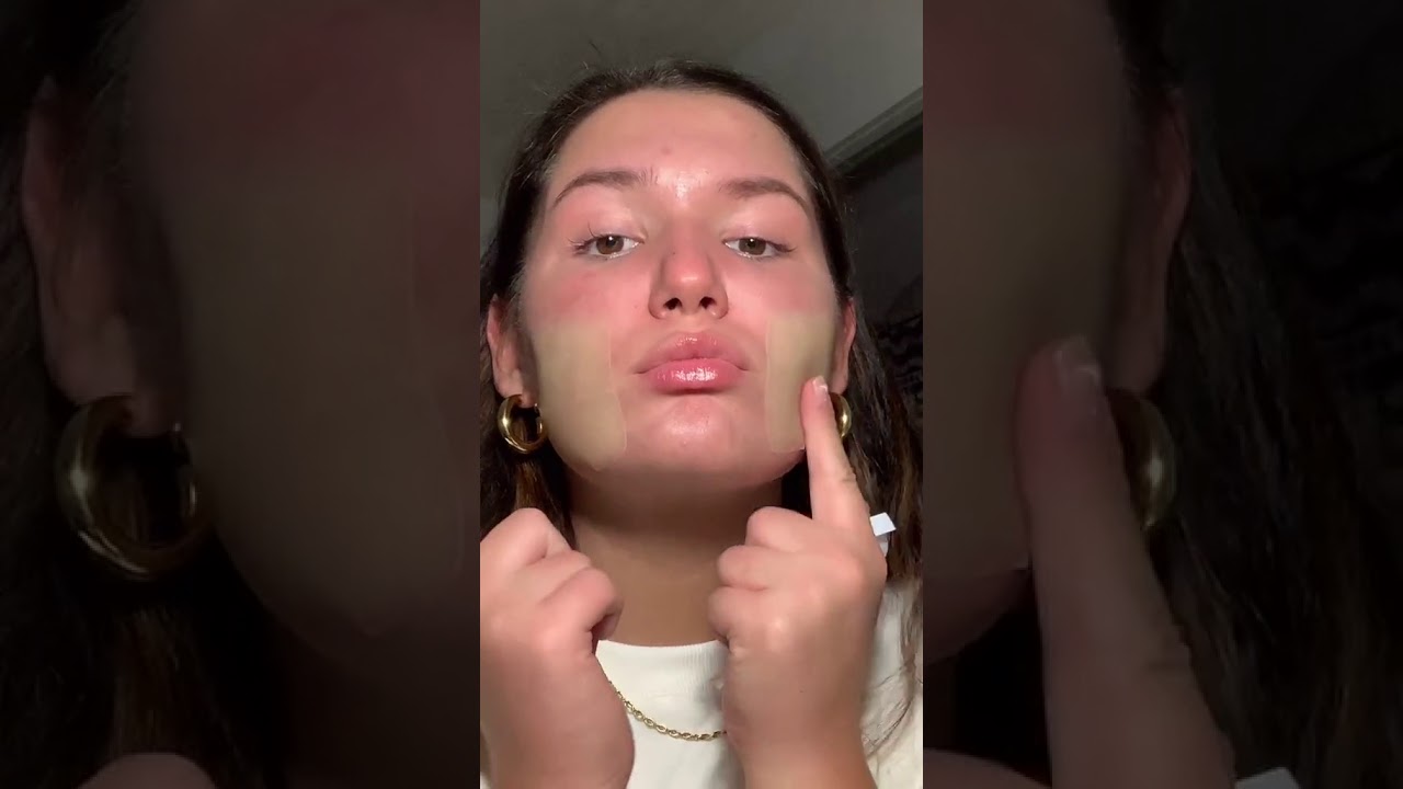 Акне 4 - YouTube