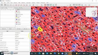 Digital pathology QuPath part 1