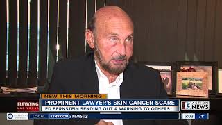 Ed Benstein shares skin cancer diagnosis