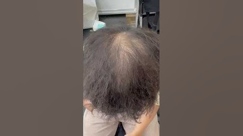 Tóc thưa như này nhìn quá già #reviewxămtóc