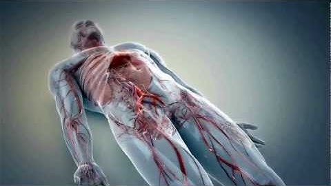 Femoral Access to Cardiac Chamber - Procedure Animation