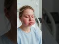 Is Facial Swelling a Sign of Kidney Disease? Causes & Warning Signs | Dr. Srikanth Nephrologist
