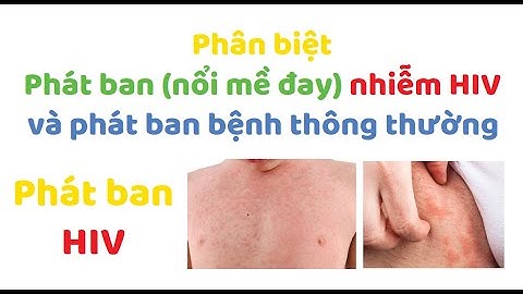 So sánh virut cúm ở người và virut hiv năm 2024