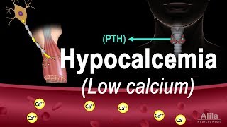 Hypocalcemia (Low Calcium) Pathology, Causes, Symptoms and Treatment, Animation