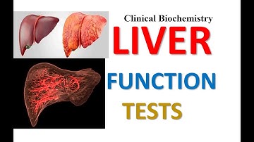 Liver Function Tests | Clinical Biochemistry | MSc | Medical Microbiology #lifesciences #pharmacy