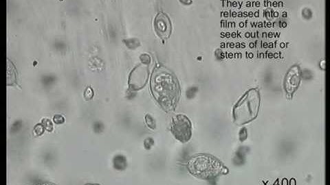 Zoospores swimming (Phytophthora sp.)