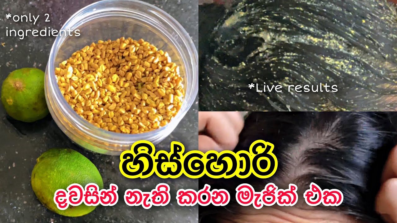 එක දවසින් හිස්හොරි නැති කරන මැජික් එක 😮 | Dandruff Treatments at home #dandruff #haircare
