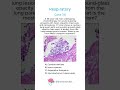 Respiratory - Case 38