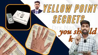 एक्यूलाइफ में yellow  point पर ट्रीटमेंट कैसे करे/best use of yellow point in aculife