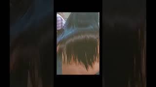 Botox Treatment Result In Ayesha Salon And Academy