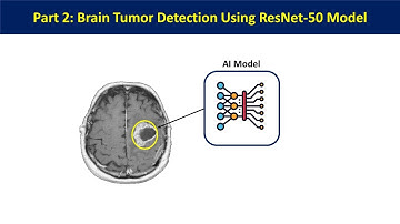 Part 2 : Brain Tumor detection Using Deep Learning | Transfer Learning ResNet | Tensorflow Keras