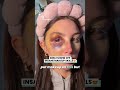 Gen Z Covers Bruise With Makeup Viralshort Gender Viralvideo