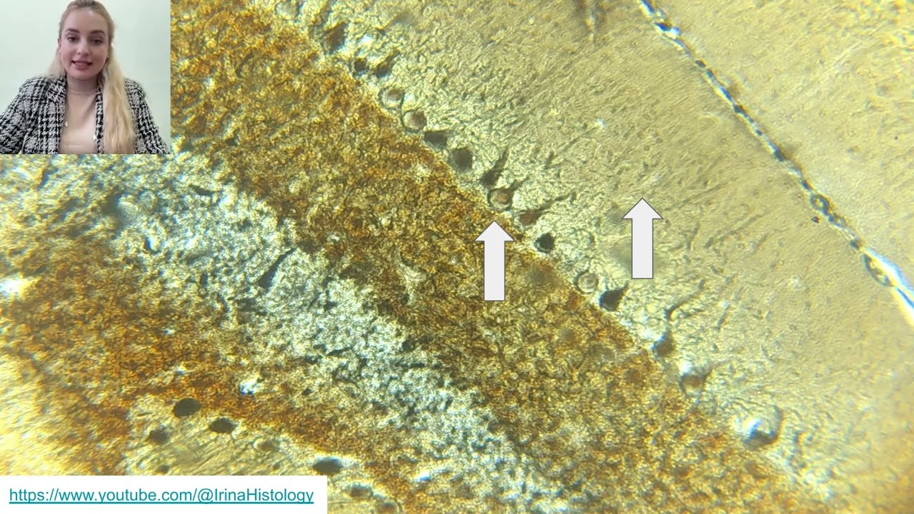 Neurons: 5 facts you should know as a medical student