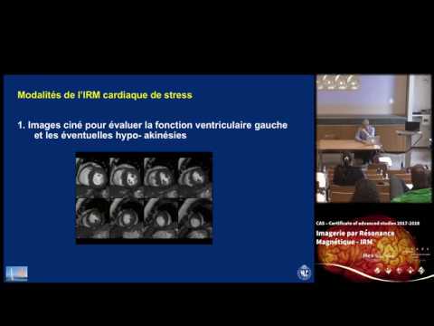 Vidéo: Quantification IRM Non Invasive De La Dynamique Du Liquide Céphalorachidien Chez Les Patients Atteints De Sclérose Latérale Amyotrophique