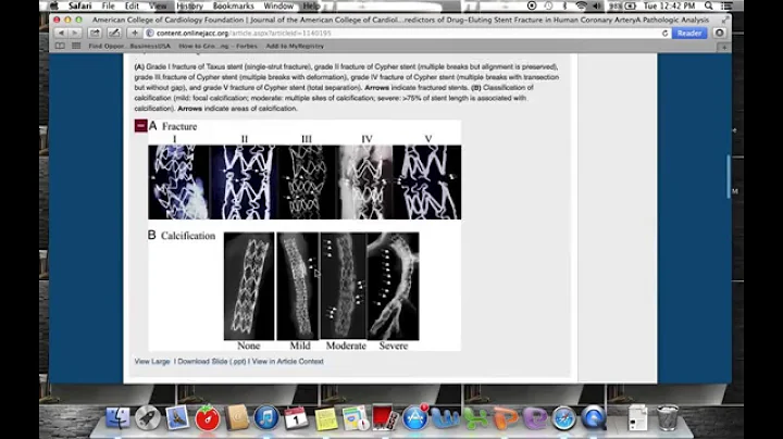 Fracture Analysis/ Histology Example Medical Devic...