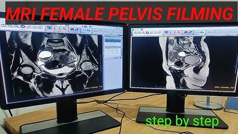 MRI FEMALE PELVIS FILMING STEP BY STEP #MRI PELVIS FILMING KESE BNATE HAI