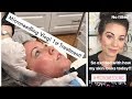 Microneedling Procedure for Acne Scars & Textured Skin: Part One