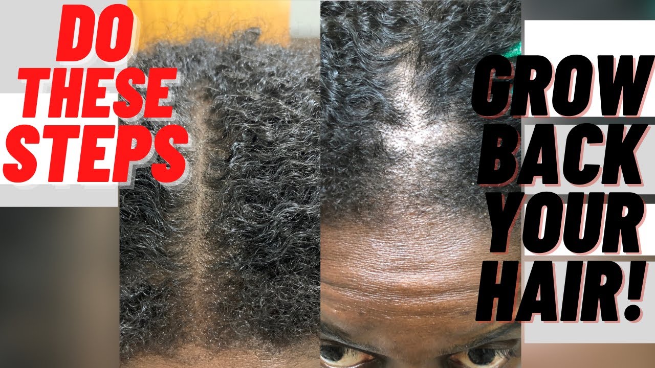 GROW YOUR HAIR BACK Easy Tips 2 Minimize Shedding & Breakage YouTube