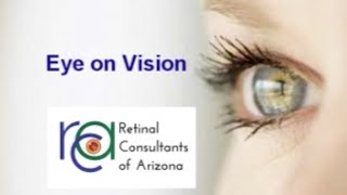 Retinal consultants of arizona presents - eye on vision: flashes &
floaters