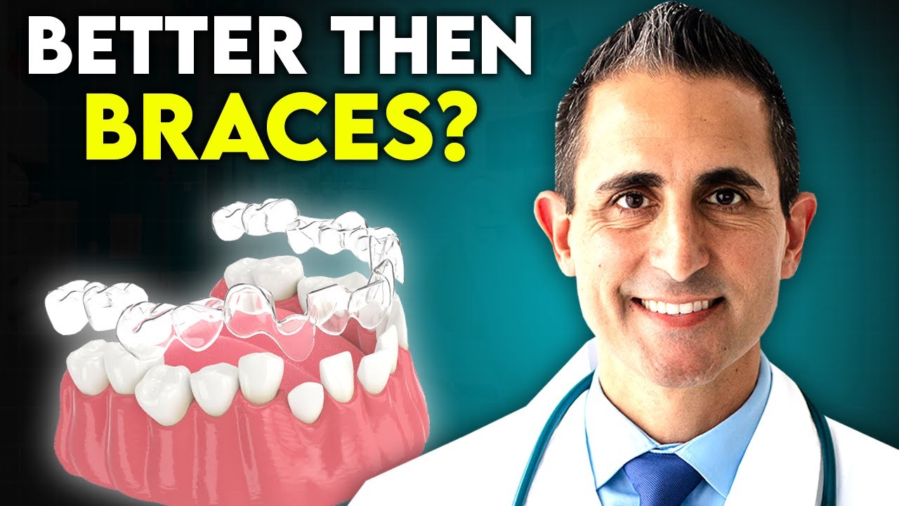 Элайнеры становятся дешевле и быстрее! Вот что вам нужно знать