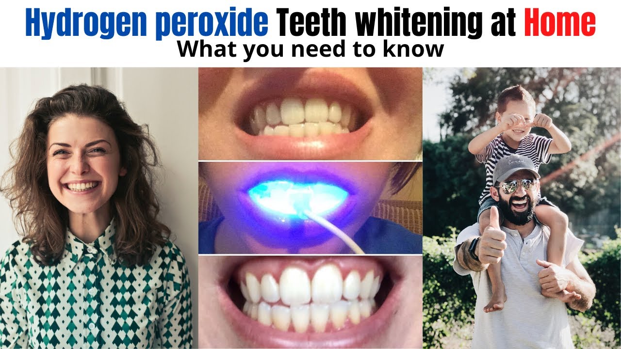 Does whitening teeth with hydrogen peroxide work