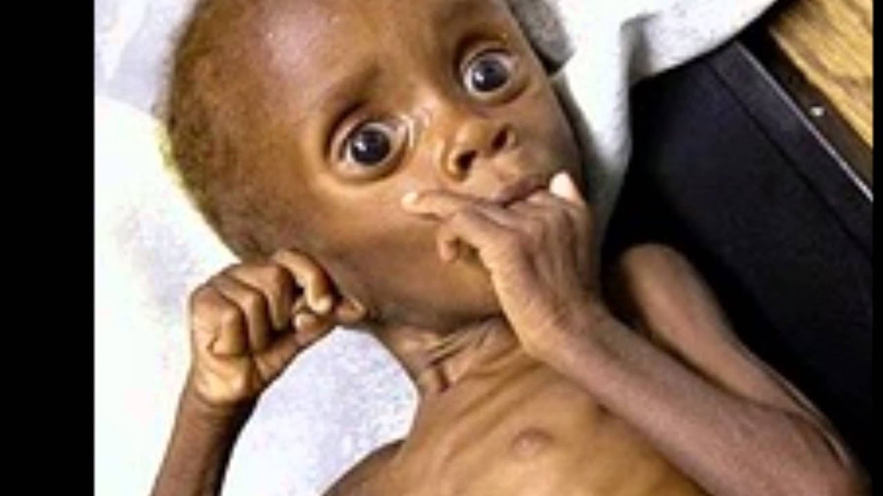 As Principais Causas Da Fome Na áfrica Resumo