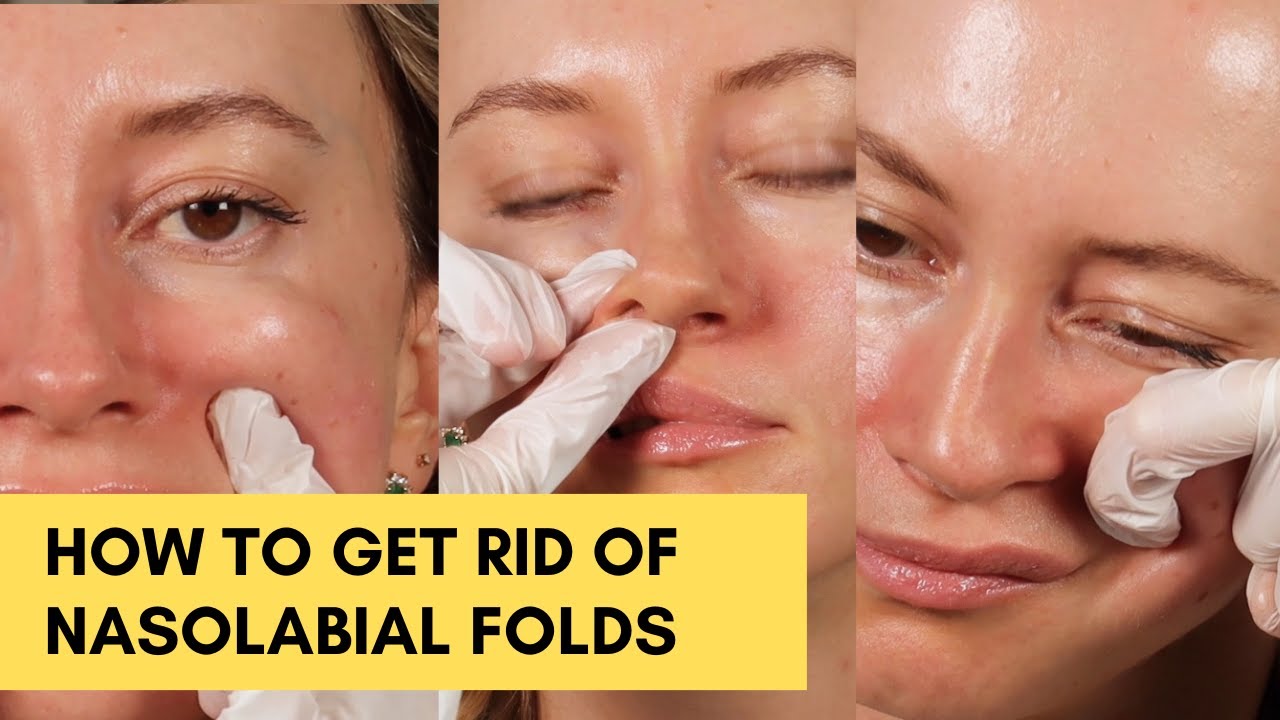 AMAZING massage to get rid of Nasolabial Folds at home - YouTube