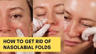 AMAZING massage to get rid of Nasolabial Folds at home