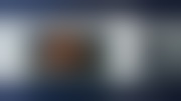 02-Transperitoneal Partial Nephrectomy: Positioning, Port Placement Docking- Ketan Badani, MD