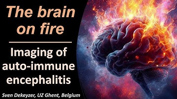 Imaging of Auto-immune Encephalitis