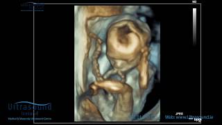 Scan of the Week: 19 Week Advanced Early Scan - Ultrasound Ireland