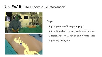 The NavEVAR research project