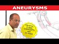 Aneurysms - Causes & Symptoms - Cardiology