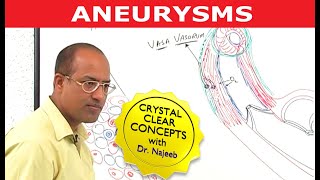 Aneurysms | Causes and Symptoms | Cardiology