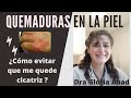 QUEMADURAS  DE PIEL. Consejo de una DERMATÓLOGA.  ¿QUÉ HACER?   🔥  💥  ⚡