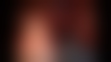 Robotic Spleen Preserving Distal Pancreatectomy