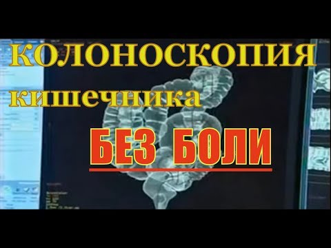 Виртуальная колоноскопия (КТ) кишечника